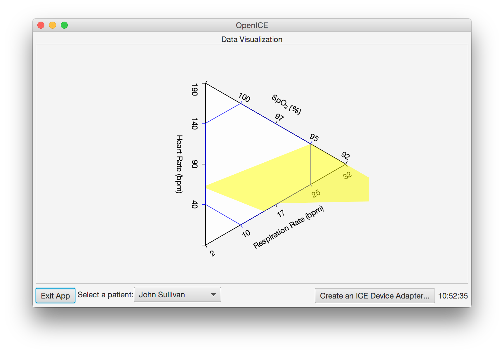 data visualization yellow